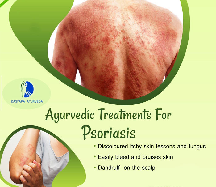 KASHYAPA AYURVEDA HEALTH CARE