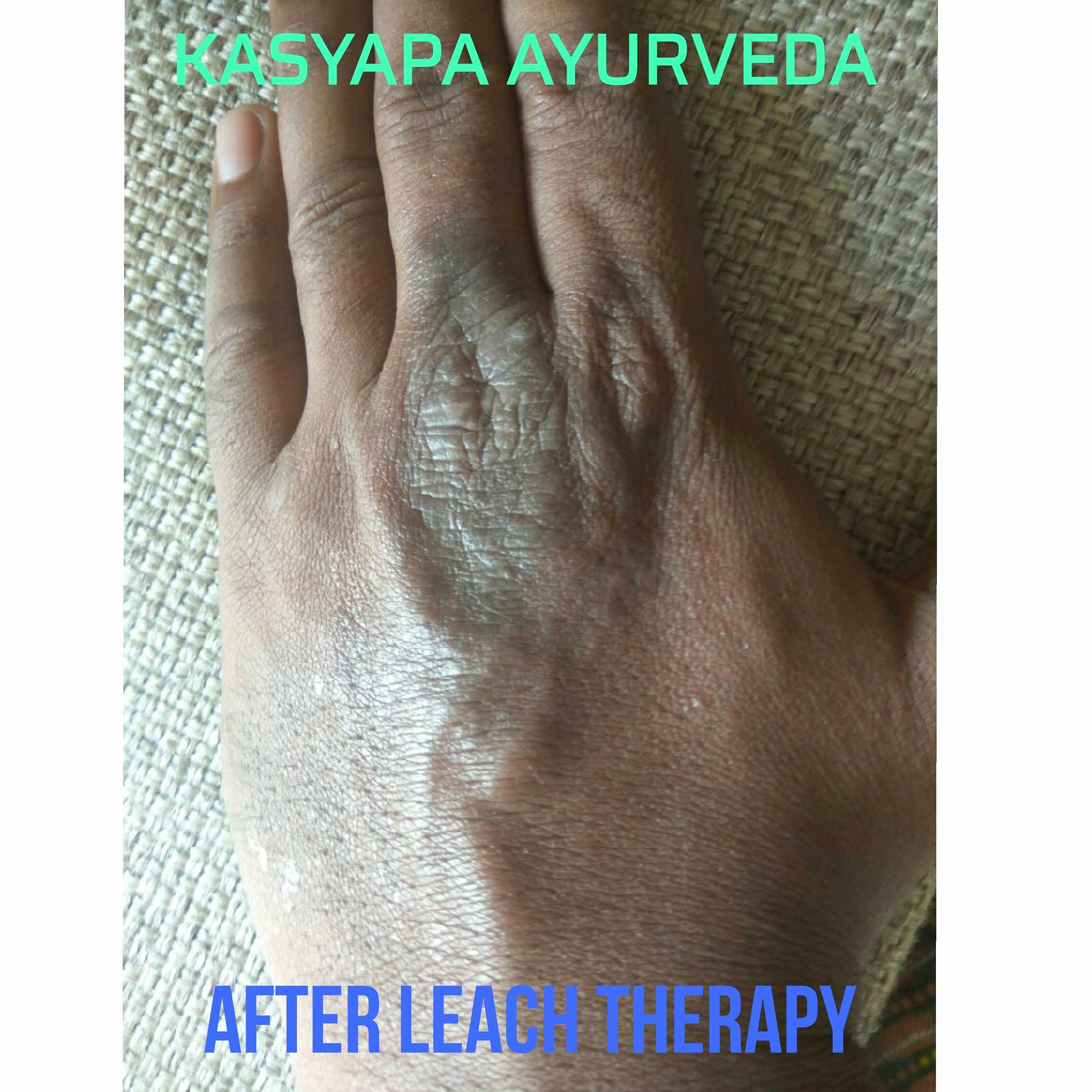 KASHYAPA AYURVEDA HEALTH CARE